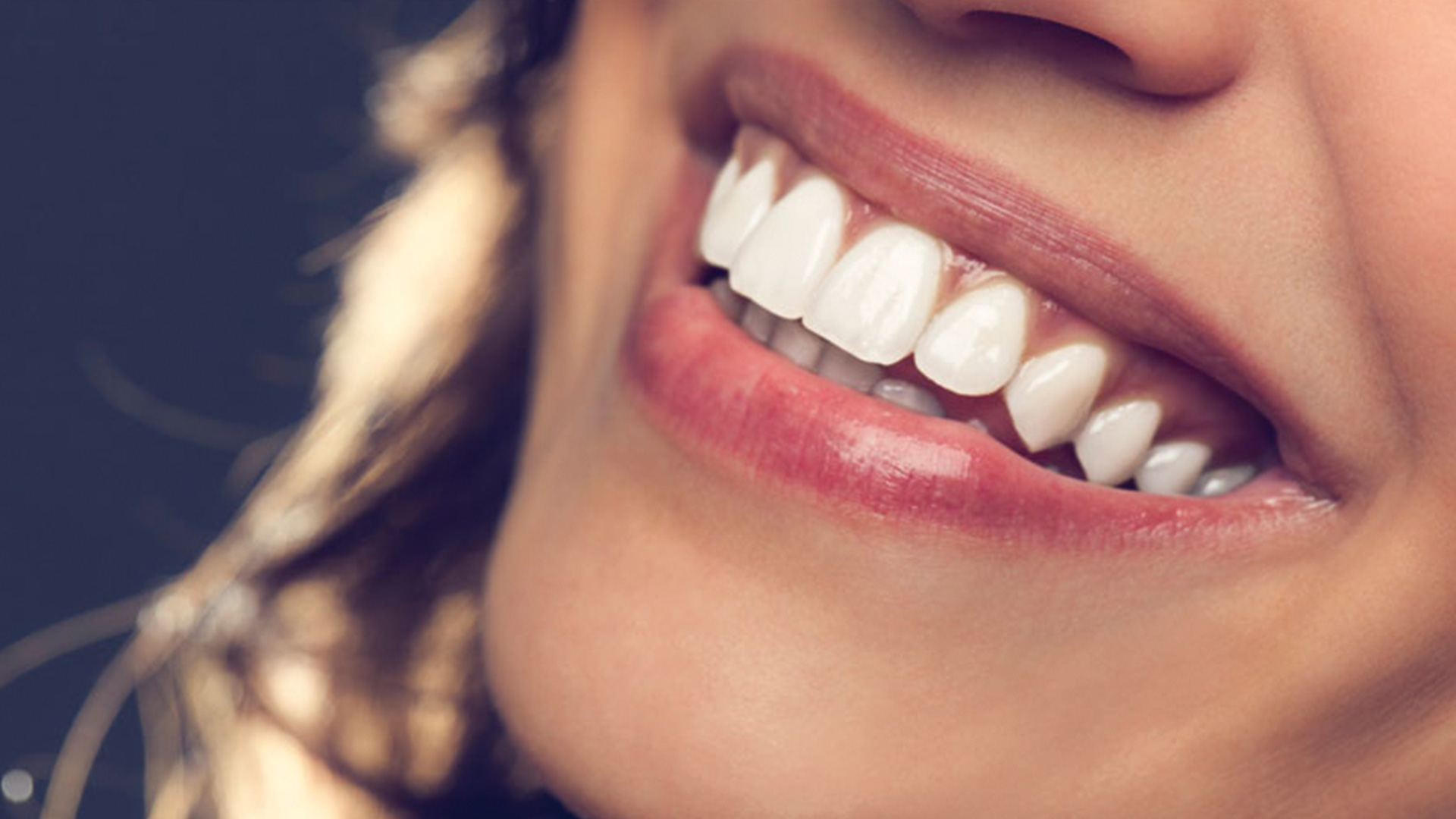 hollywood smile turkey, dental tourism